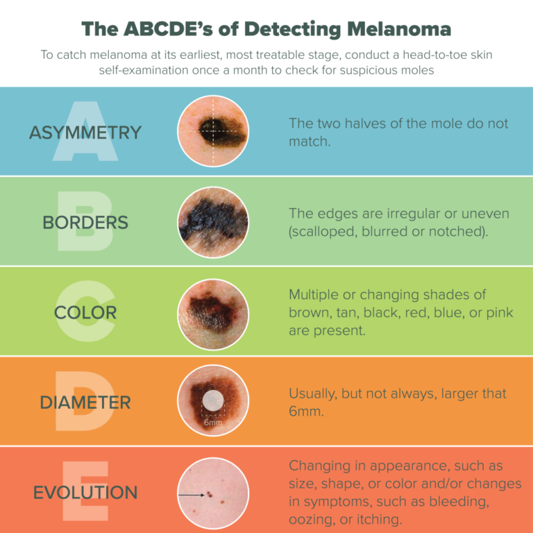 Melanoma-Infographic copy - Johnson County Dermatology